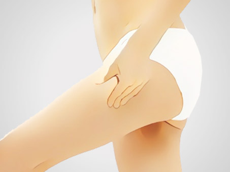 大腿减肥